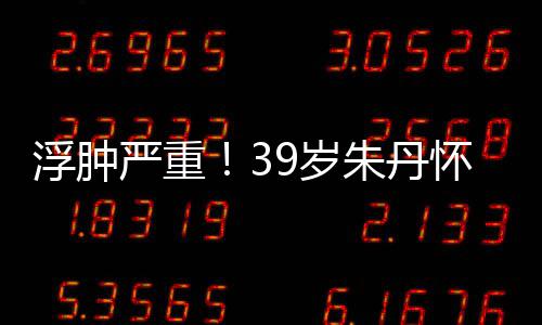 坚持带货严重月 朱丹直播7个怀孕9岁深夜浮肿